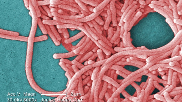 Legionella bacteria 