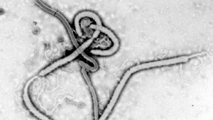 A transmission electron micrograph shows the ultrastructural morphology displayed by an Ebola virus virion. (Centers for Disease Control and Prevention)