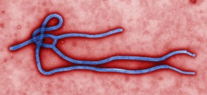 This photo provided by the CDC shows an Ebola Virus. U.S. health officials are monitoring the Ebola outbreak in Africa but say the risk of the deadly germ spreading to the United States is remote. (AP / CDC) 