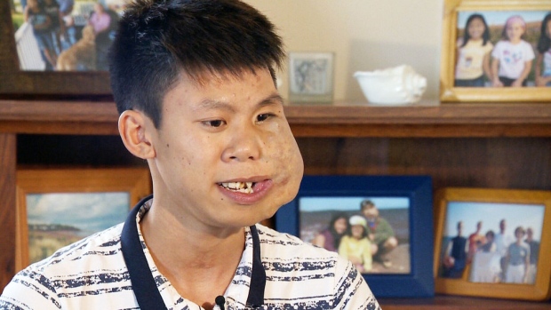 Vietnamese teen reunites with life-saving 'Canadian family'
