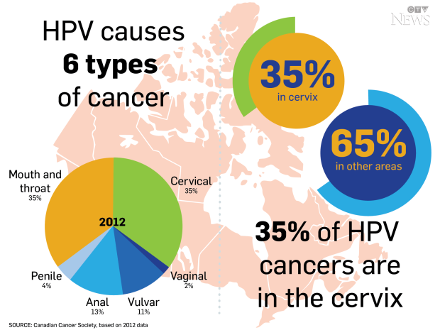 Infographic Hpv Mouth And Throat Cancers On The Rise Ctv News