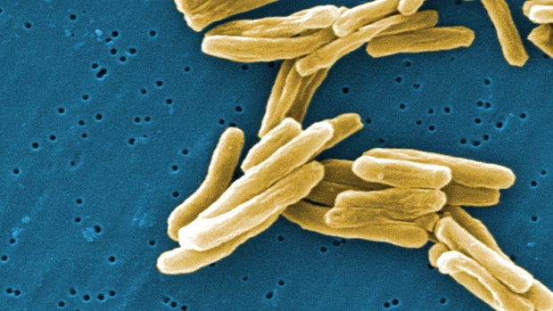 The Mycobacterium tuberculosis (TB) bacteria is shown in a 2006 high magnification scanning electron micrograph (SEM) image. (CDC - Janice Carr)
