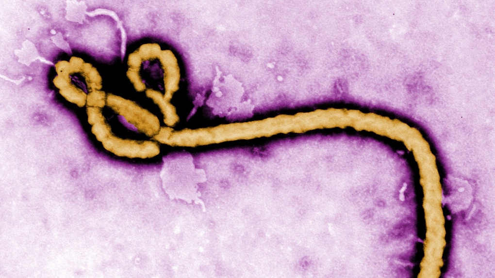 In this undated colorized transmission electron micrograph file image made available by the CDC shows an Ebola virus virion. (Frederick Murphy / CDC via AP)