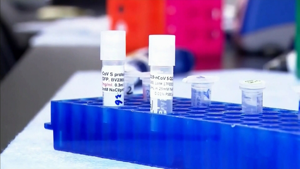 Coronavirus: Laporan Manitoba mencatat 1.494 kasus pada hari Jumat;  lima kematian baru ditambahkan