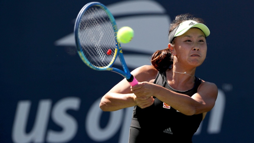Siapa yang merindukan bintang tenis China Peng Shuai?