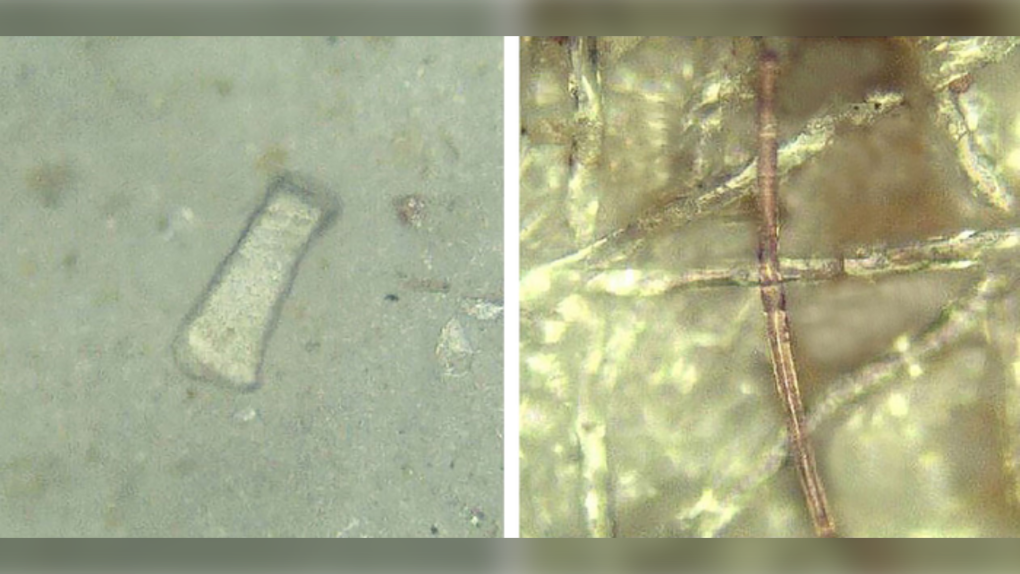 These photos show two types of microplastics that were found in the fecal samples of the participants. (Environmental Science & Technology)