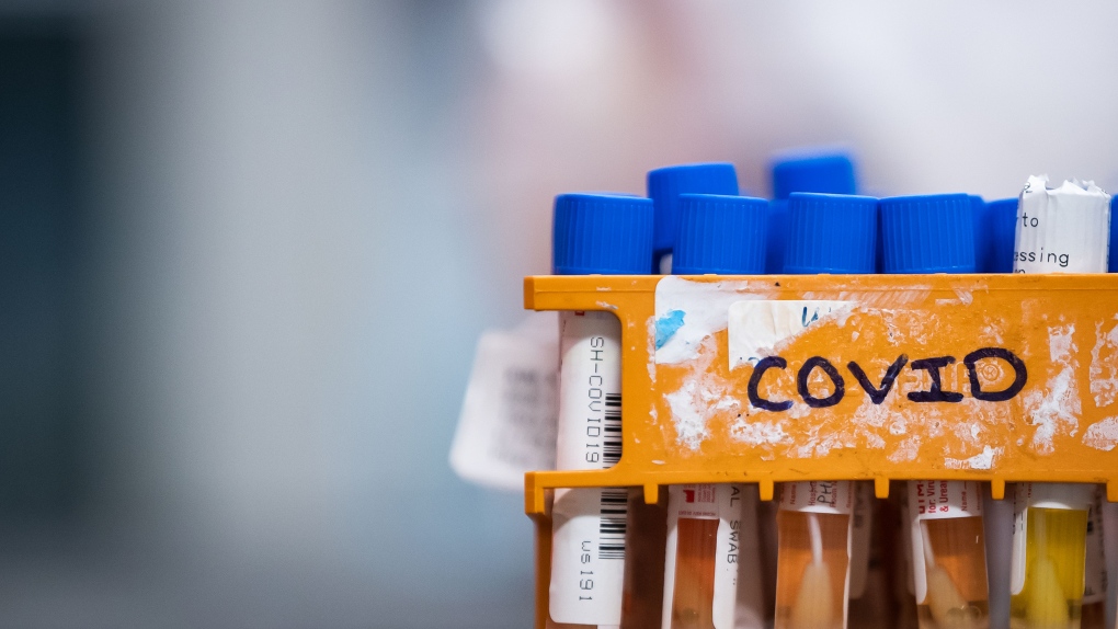 Coronavirus: Manitoba menyatakan wabah COVID-19 di 10 rumah perawatan pribadi