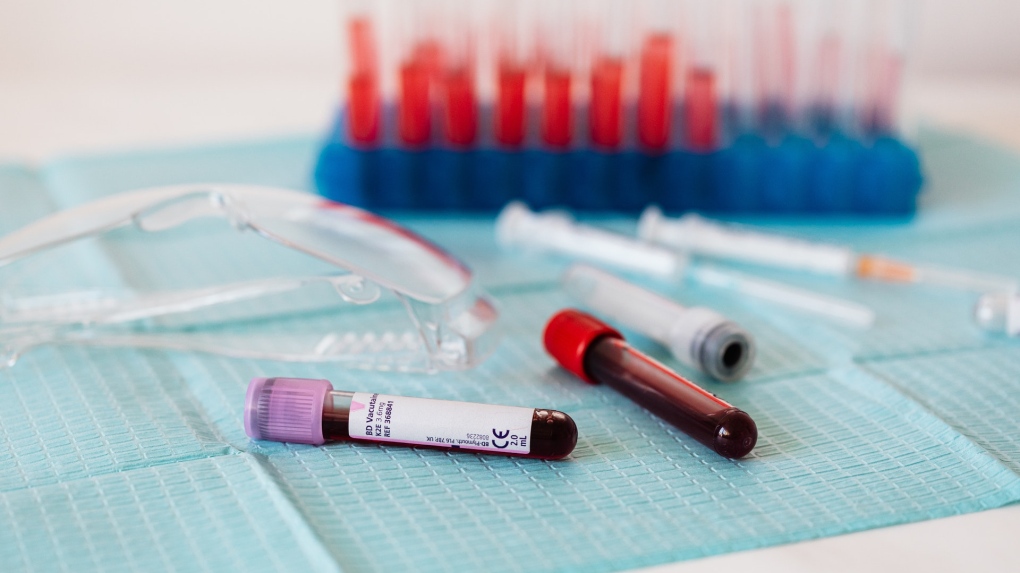 Blood samples are seen in this stock photo. (Pexels)
