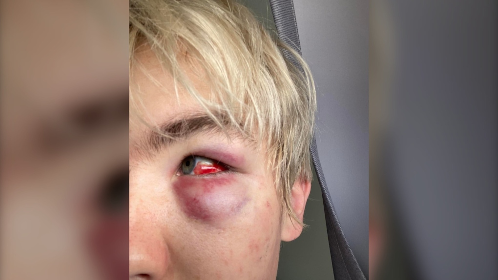 'It's vile': Man arrested as Nanaimo RCMP investigate assault as possible hate crime