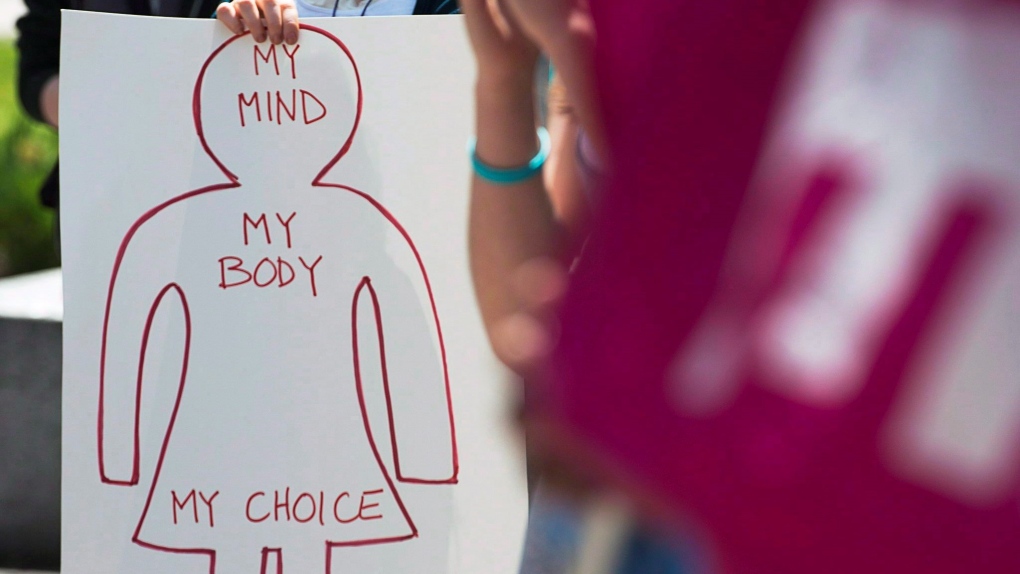 Aborsi di Kanada: Seberapa mudah aksesnya?