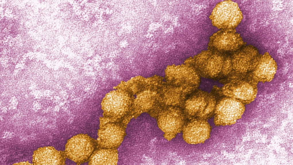 An electron micrograph of the West Nile virus is shown. New York City reported two human cases of the virus on August 16. (Cynthia Goldsmith/CDC/CNN)