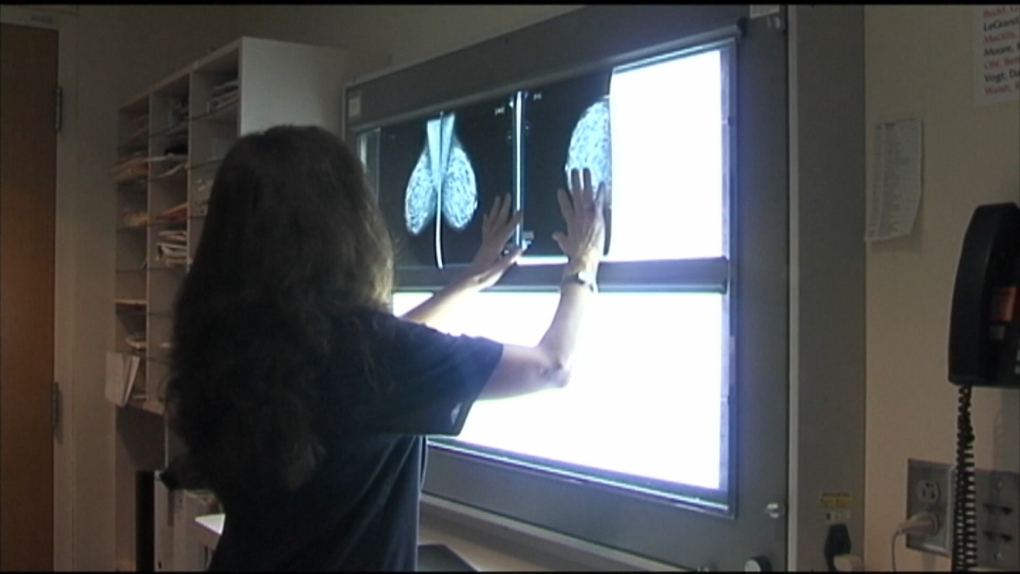 Le donne della Columbia Britannica possono sottoporsi a mammografie a partire dai 40 anni, quindi perché no?