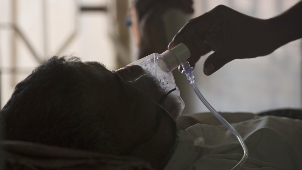 Ukraine, Sudan conflicts fuel alarming surge in tuberculosis
