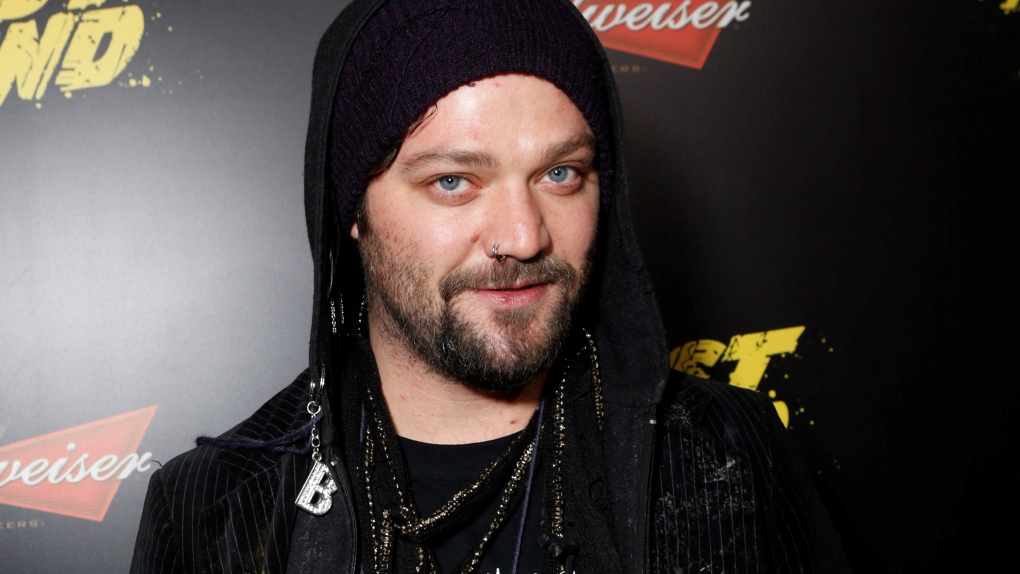 ‘Jackass’ star Bam Margera to stand trial on assault charge in fight with brother, judge rules