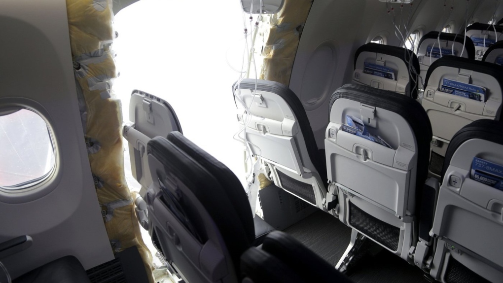 Boeing 737 Max 9: a los viajeros de Canadá se les pidió que se facturaran para los vuelos