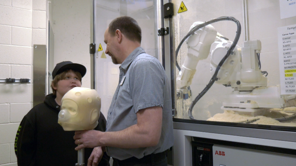 Glenrose realizza le protesi utilizzando un intagliatore robotico a 7 assi