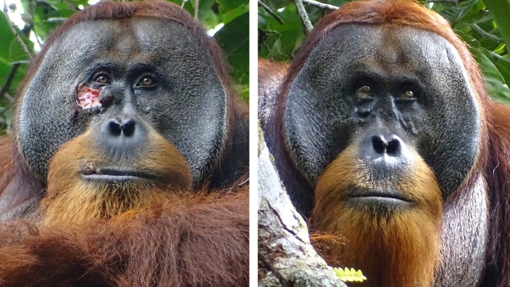 Esta fotografía combinada muestra una herida facial en Rakus, un orangután de Sumatra, el 23 de junio de 2022, dos días antes de que le aplique hojas de una planta medicinal, a la izquierda, y el 25 de agosto de 2022, después de que su herida facial fuera apenas visible (Armas , Fundación Safruddin/Suaq vía AP)