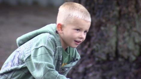 Jakob Temple is set to undergo a very rare operation in the U.S. in January. Oct. 24, 2010. (CTV)