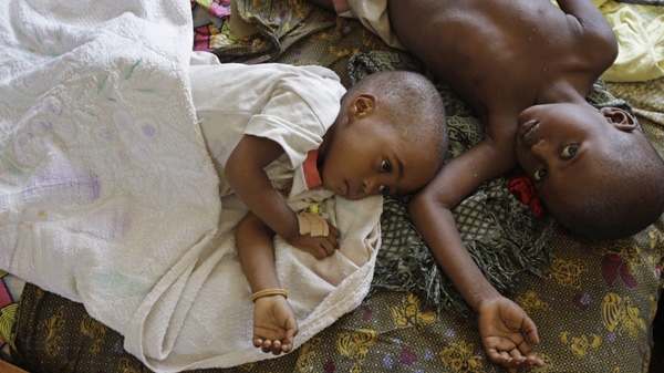 Two children with malaria rest at the local hospital in the small village of Walikale, Congo, in this Sunday, Sept. 19, 2010 file photo. (AP Photo/Schalk van Zuydam, file)