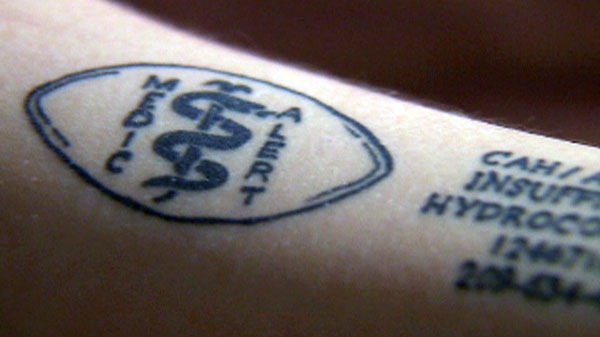 Emma Bortolon-Vuttor says her tattoo cost her about $150, and includes her MedicAlert registration number.