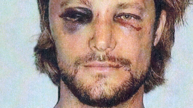Gabriel Aubry after the fight