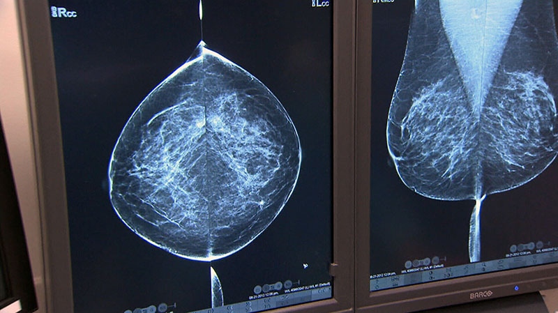 Taking breast cancer drug longer may save more