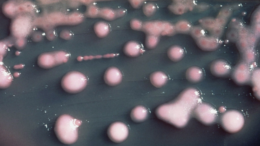  Klebsiella pneumoniae bacteria