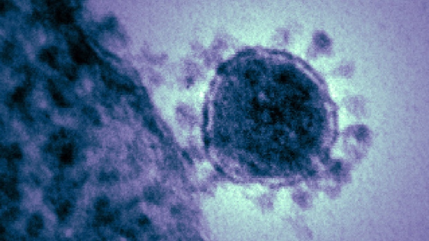 Coronavirus SARS-like virus infections 