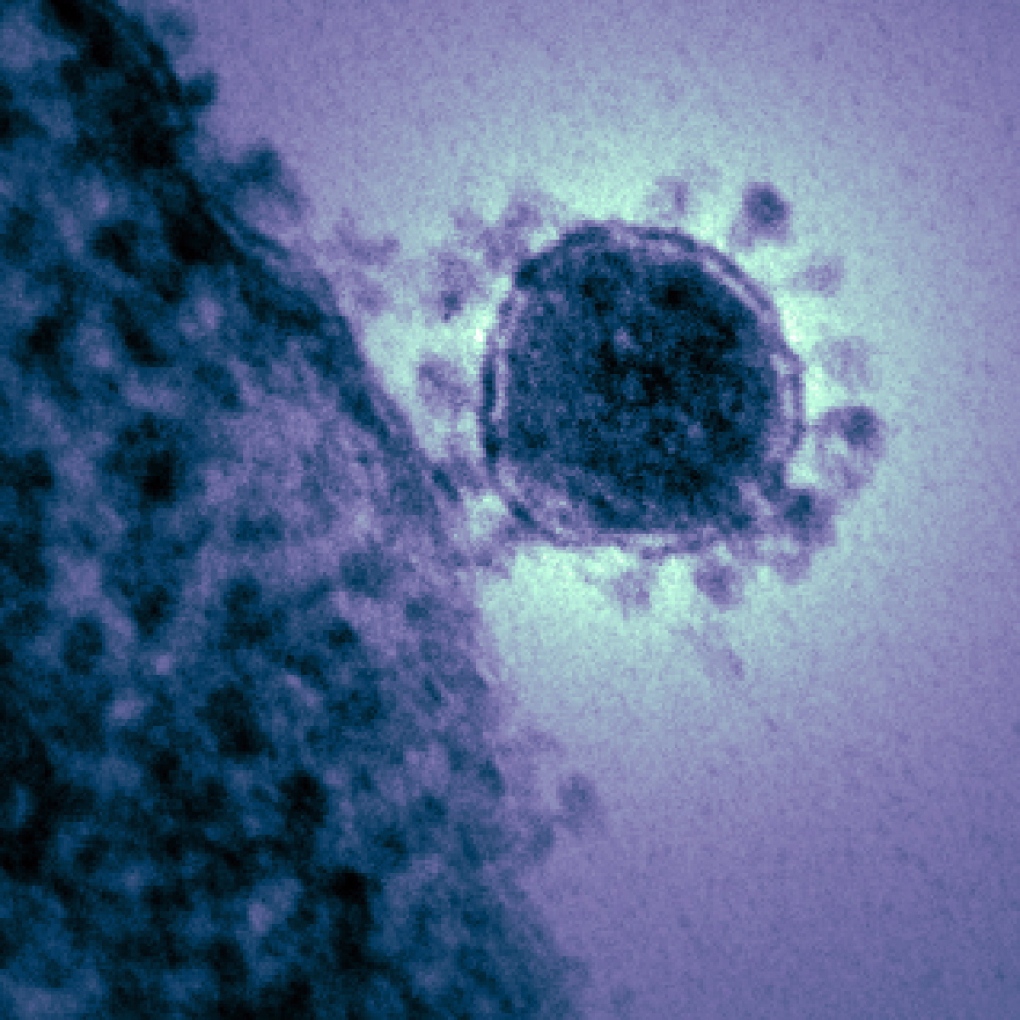 Coronavirus transmission electron micrograph