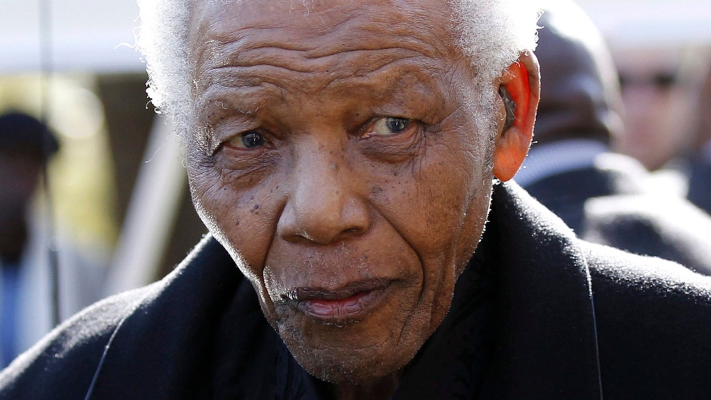 Nelson Mandela undergoes surgery
