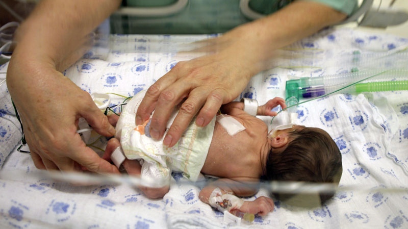 A premature baby is touched through an incubator at the Sourasky Medical Center in Tel Aviv, Israel, Thursday, Dec. 10, 2009. (AP Photo/Ariel Schalit)