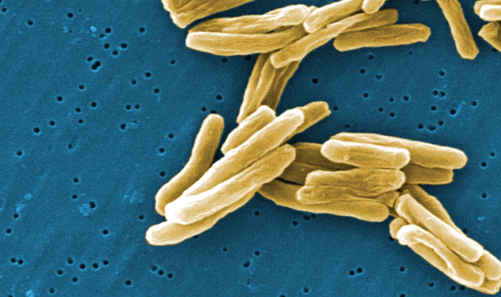 The Mycobacterium tuberculosis bacteria