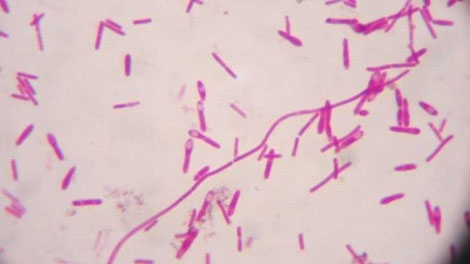 This undated color enhanced photo shows the clostridium botulinum bacteria which may cause botulism, a life-threatening illness. 