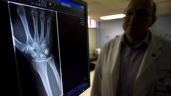 Dr. C. Stewart Wright stands beside an X-Ray of a fractured wrist displayed on a computer monitor at the Holland Orthopaedic & Arthritic Centre in Toronto Wednesday, January 20, 2010. (THE CANADIAN PRESS/Darren Calabrese)