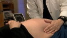 Gaining too much weight during pregnancy can impact the baby's health.