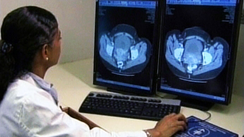 Doctor looks at image of ovarian cancer