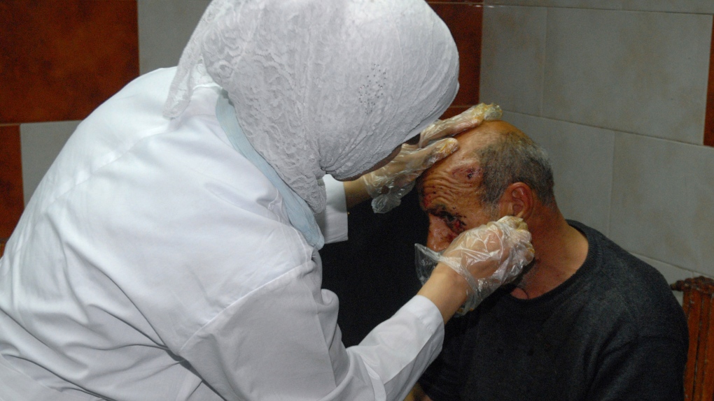 Syria attack, chemical weapons