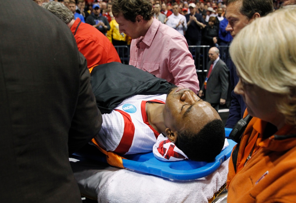 Louisville&#39;s Ware leaves game on stretcher with gruesome break to right leg | CTV News