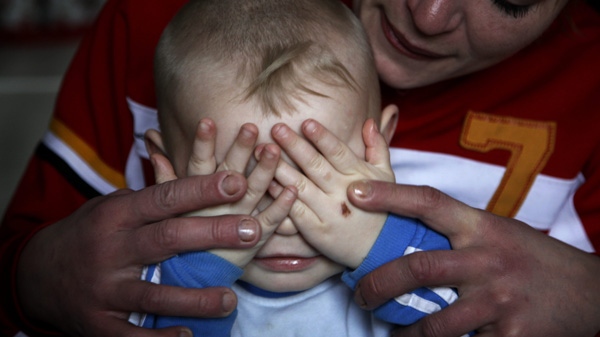 In this Tuesday, Feb. 1, 2011 photo, Andrei, a 2-year-old HIV-positive boy hides his face in his hands as his mother Yelena, 33 embraces him in Cherkassy, Ukraine. (AP Photo/Efrem Lukatsky)