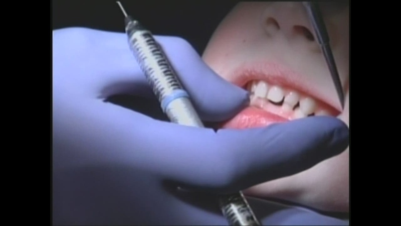 Teeth generic, dentist generic