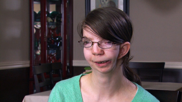 Turning around a lifetime of taunts, Ontario woman takes on CNN | CTV News