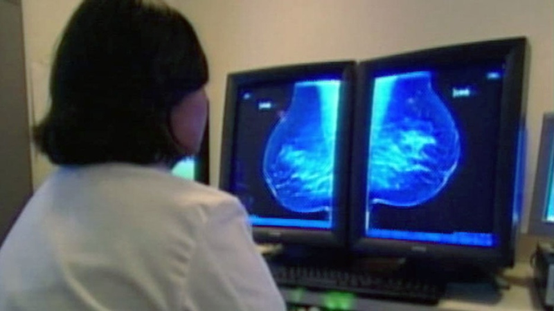 CTV Ottawa: Faster breast cancer diagnosis 
