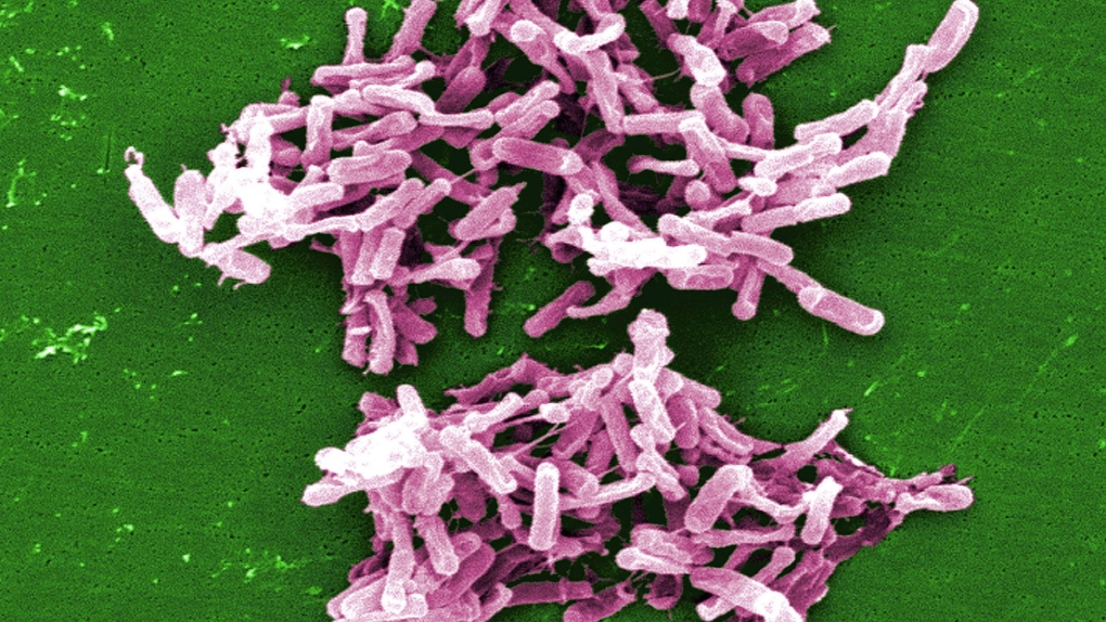 Small U.S. study reports 90% success rate in treating C. difficile with 'poo' pills