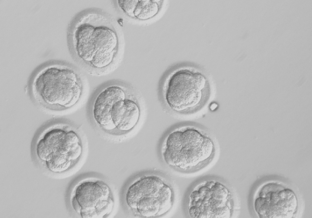 Stem cells cloned embryos