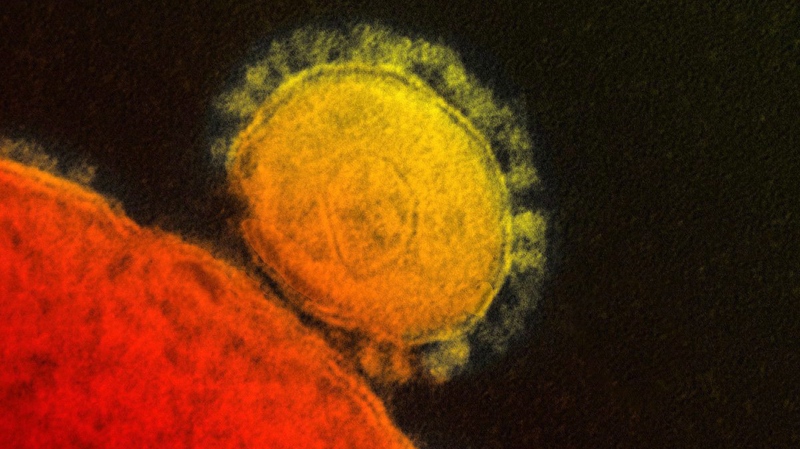 Three cases of MERS in South Korea