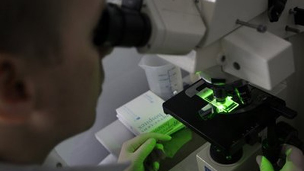 A research team member looks through a microscope of bacteria use for producing anti-body against malaria at Westminster University in London, Tuesday, March 15, 2011. (AP Photo/Sang Tan)