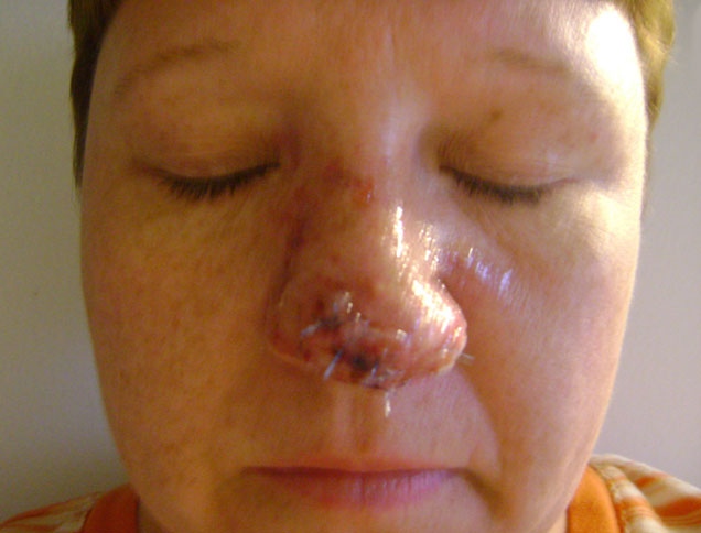 Anne Riel had the tip of her nose bit off when she greeted a customer and her dog at a Home Depot store on Cyrville Road in Ottawa, Friday, April 15, 2011.