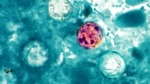 A photomicrograph of a fresh stool sample, which had been prepared using a 10% formalin solution, and stained with modified acid-fast stain, reveals the presence of four Cyclospora cayetanensis oocysts in the field of view. (Center for Disease Control and Prevention)