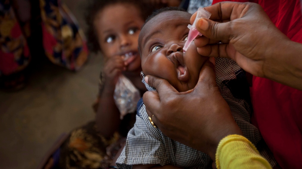 Polio outbreak in Somalia