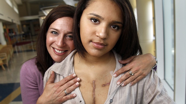 Teen bond overcomes girl's heart transplant fear | CTV News